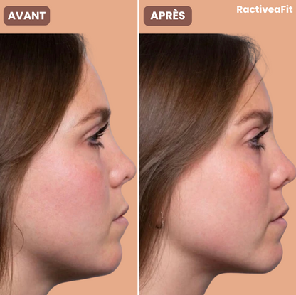 RactiveaFit | Gaine liftante visage