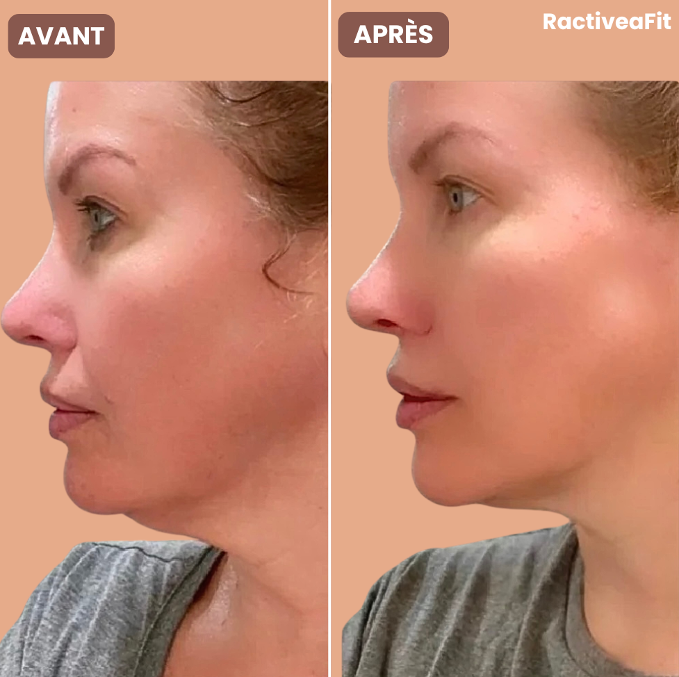 RactiveaFit | Gaine liftante visage