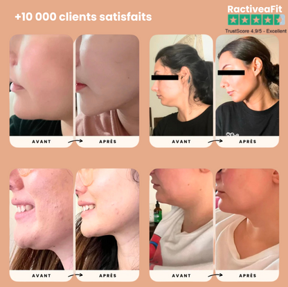 RactiveaFit | Gaine liftante visage